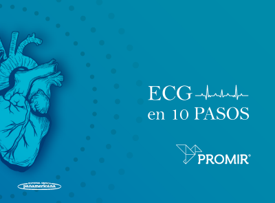 ECG en 10 pasos