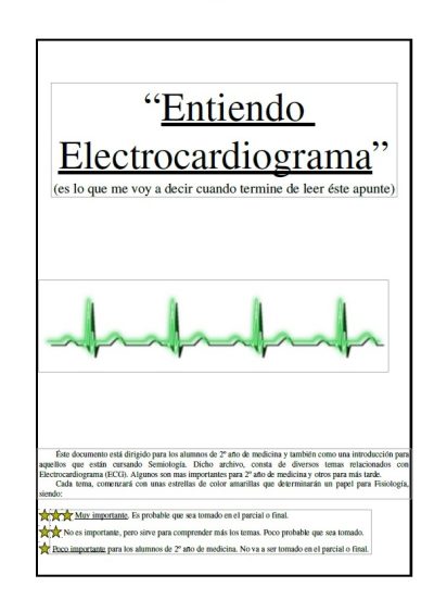 Entiendo ECG