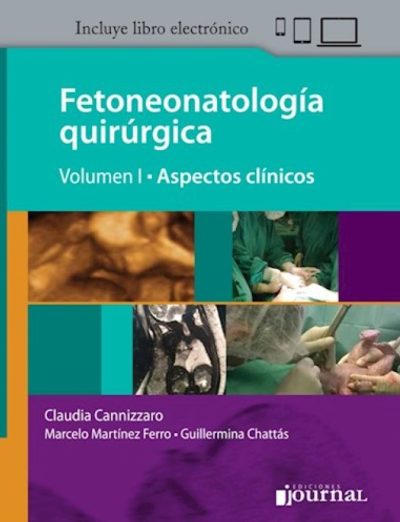 Fetoneonatología quirúrgica T1