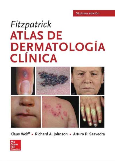 Fitzpatrick Atlas 7 Ed