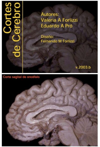 Pro-Forlizzi apunte + imágenes