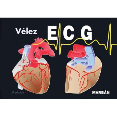 Vélez ECG