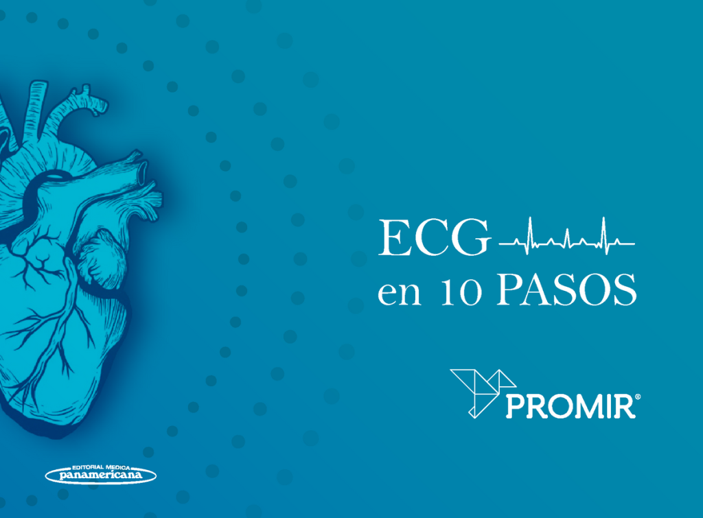 ECG en 10 Pasos