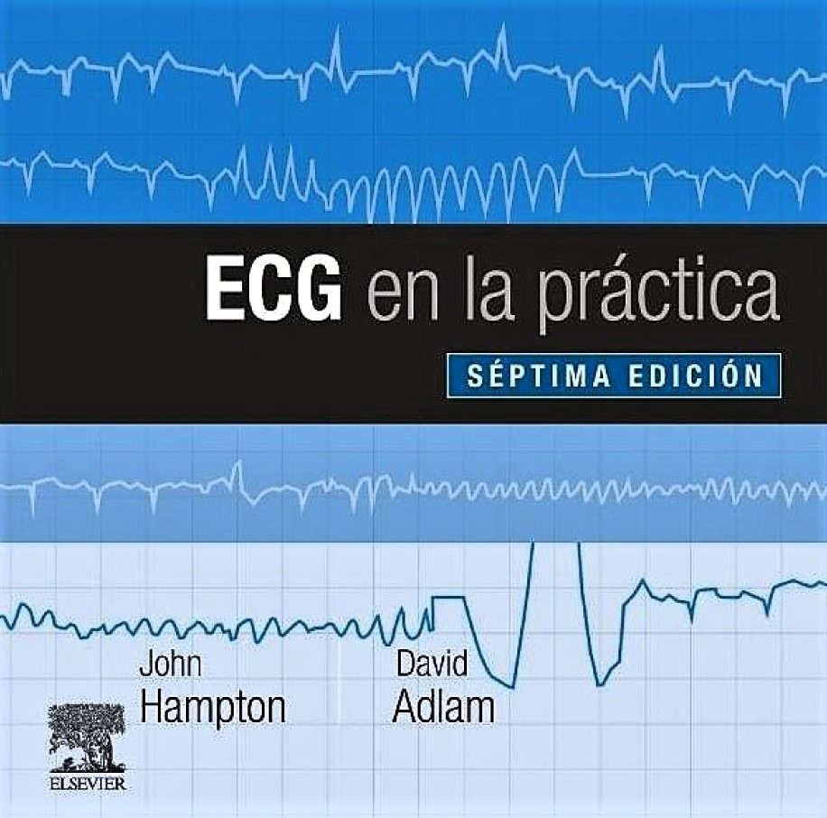 ECG en la Práctica 7.ª Ed