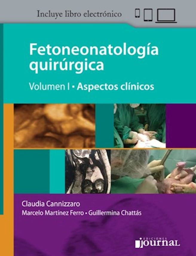 Fetoneonatología Quirúrgica T1
