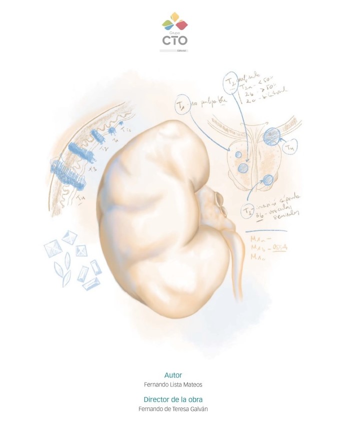 Manual CTO – Urología